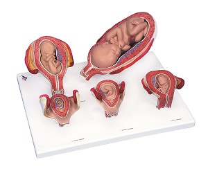 Zwangerschapsserie - 5 Modellen